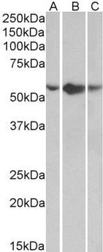 TNFR1 Polyclonal Antibody