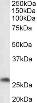 PTGDS Polyclonal Antibody