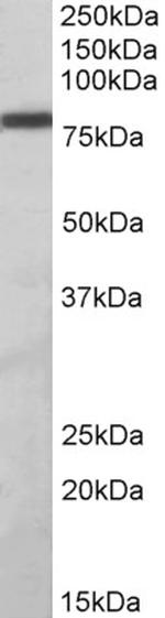 ZBTB24 Antibody in Western Blot (WB)