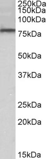 DYRK1A Polyclonal Antibody