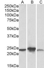 ABHEB Polyclonal Antibody