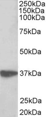 EMAP II Polyclonal Antibody