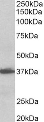 EMAP II Antibody in Western Blot (WB)