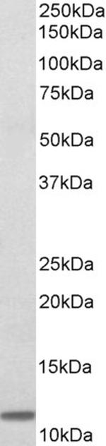 beta-2 Microglobulin Antibody in Western Blot (WB)