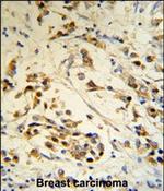 RBM3 Polyclonal Antibody