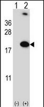 RBM3 Antibody in Western Blot (WB)