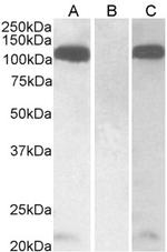 Furin Polyclonal Antibody