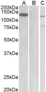 MIB1 Antibody in Western Blot (WB)
