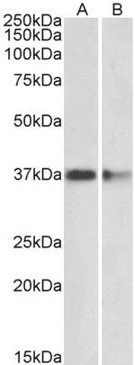 PRMT2 Polyclonal Antibody