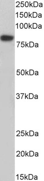 Coilin Polyclonal Antibody