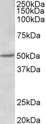 Estrogen Receptor beta Antibody in Western Blot (WB)