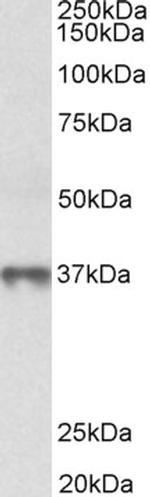 MAT2B Polyclonal Antibody