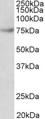 FUBP1 Antibody in Western Blot (WB)