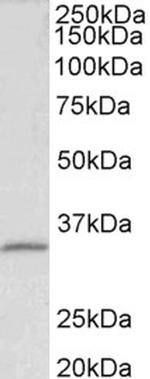 Fibrillarin Polyclonal Antibody