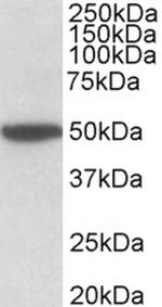 CHRM2 Polyclonal Antibody
