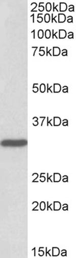 PCNA Antibody in Western Blot (WB)