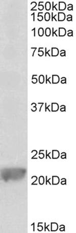 GPX1 Polyclonal Antibody