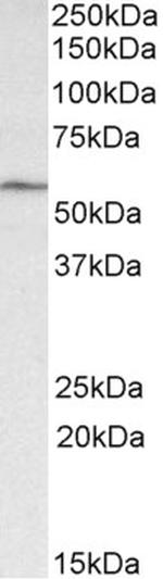 GLP1R Antibody in Western Blot (WB)