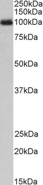 CSF3R Antibody in Western Blot (WB)