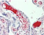 Complement C3 Antibody in Immunohistochemistry (Paraffin) (IHC (P))