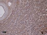 MMP3 Polyclonal Antibody