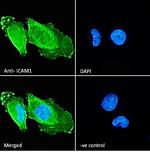 ICAM-1 (CD54) Antibody in Immunocytochemistry (ICC/IF)