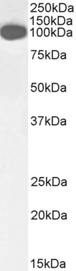 ICAM-1 (CD54) Antibody in Western Blot (WB)