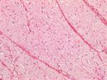 CTGF Antibody in Immunohistochemistry (Paraffin) (IHC (P))