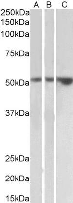 KIM-1 Polyclonal Antibody