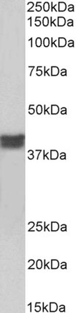 Cardiac Troponin T Polyclonal Antibody