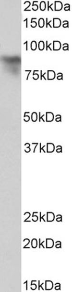 Periostin Antibody in Western Blot (WB)
