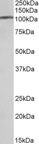 AP2A1 Polyclonal Antibody