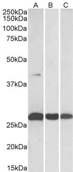 MKP3 Polyclonal Antibody