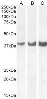 HOXD13 Polyclonal Antibody