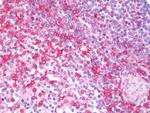 MIA Antibody in Immunohistochemistry (Paraffin) (IHC (P))