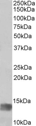 MIA Antibody in Western Blot (WB)
