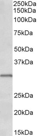 IGFBP-1 Antibody in Western Blot (WB)