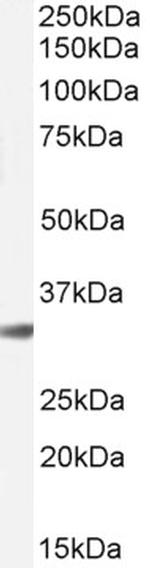 Cathepsin B Antibody in Western Blot (WB)