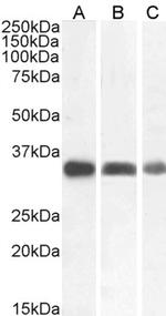 Cathepsin B Antibody in Western Blot (WB)