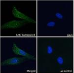 Cathepsin B Polyclonal Antibody