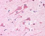FAM44A Antibody in Immunohistochemistry (Paraffin) (IHC (P))