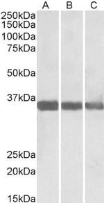 MDH1 Polyclonal Antibody