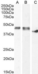 Creatine Kinase MM Polyclonal Antibody