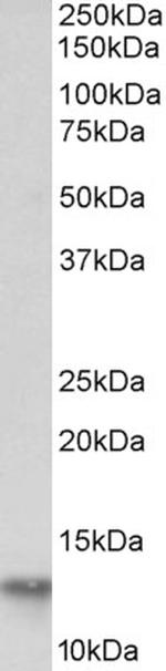 FABP4 Antibody in Western Blot (WB)