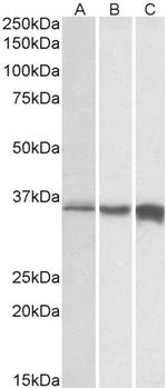 TNNT3 Polyclonal Antibody, Biotin