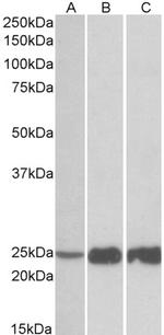 TNNI2 Polyclonal Antibody