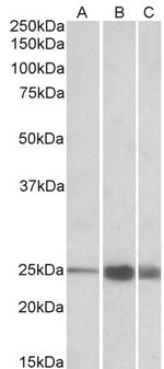 TNNI2 Polyclonal Antibody