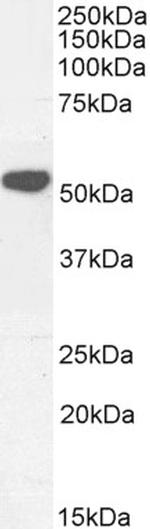 KATNAL2 Polyclonal Antibody