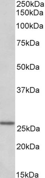 NTAL Polyclonal Antibody