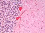 YLAT2 Antibody in Immunohistochemistry (Paraffin) (IHC (P))